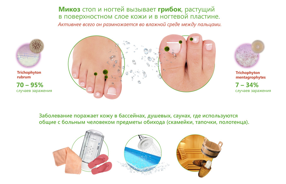 nogtey-2
